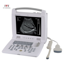 MT Medical China Digital Portable Veterinary Ultrasound Price
